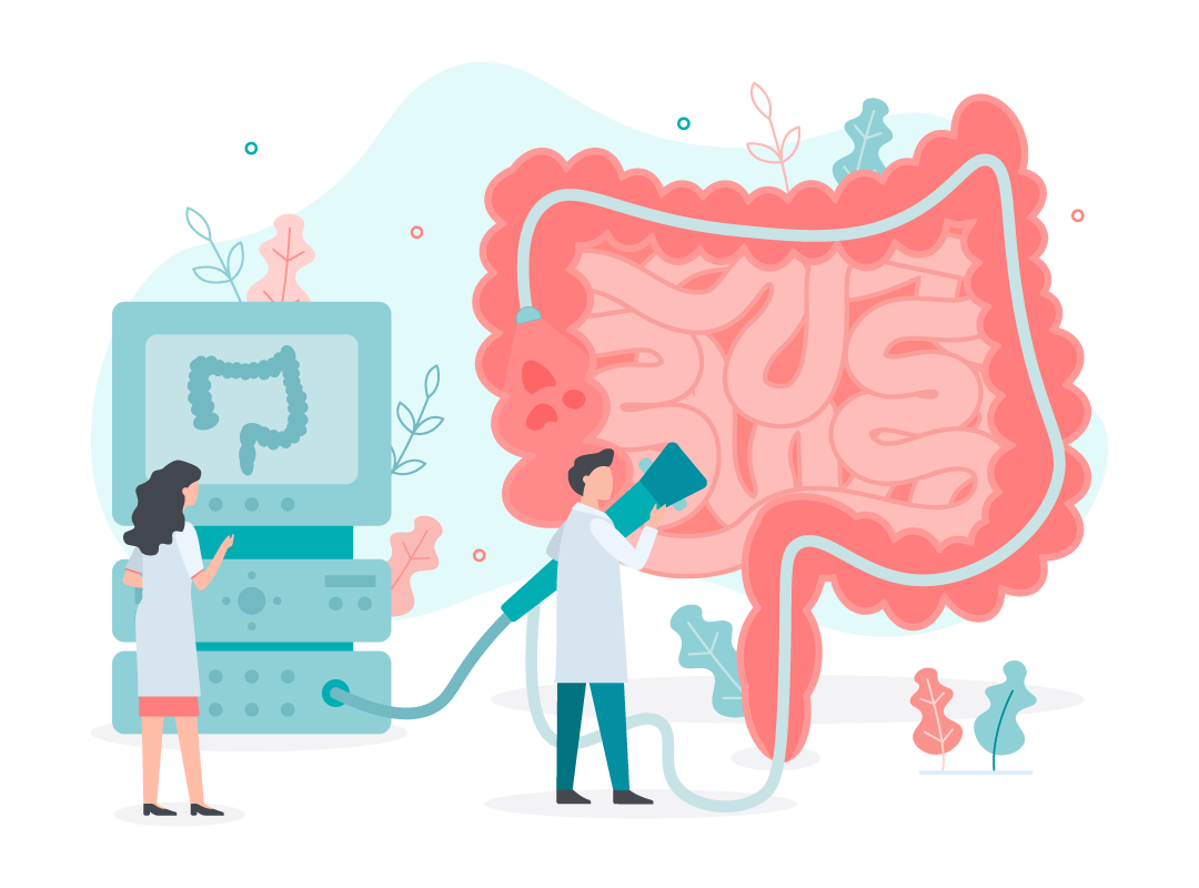 colonoscopy-graphic-miramontwellnesscenters
